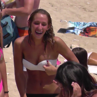 Braces girl in black and white bikini